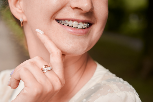 أضرار تقويم الأسنان على المدى البعيد