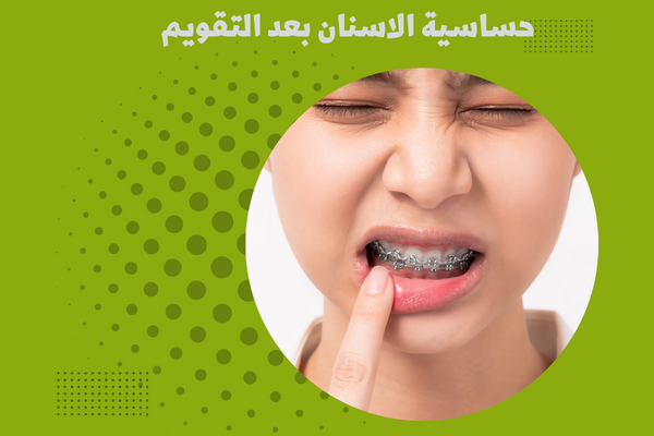 حساسية الاسنان بعد التقويم
