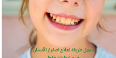 أسهل طريقة لعلاج اصفرار الأسنان في 4 خطوات فقط وطريقة تبييض الأسنان بالفحم