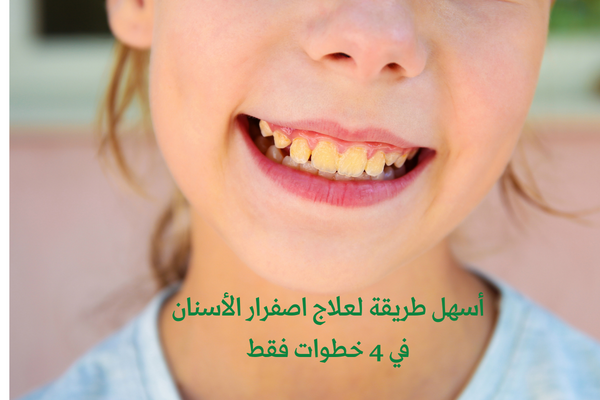 أسهل طريقة لعلاج اصفرار الأسنان في 4 خطوات فقط