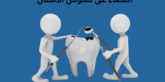القضاء على تسوس الاسنان.. وكيفية التخلص من مشكلة تسوس الأسنان نهائياً