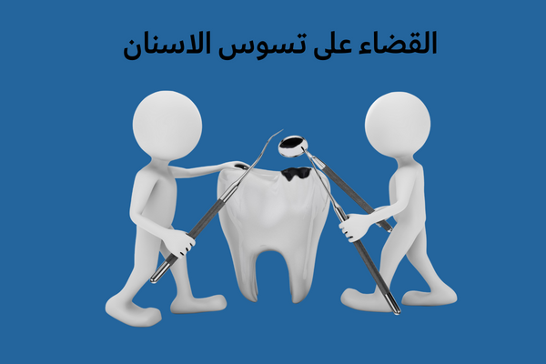 القضاء على تسوس الاسنان
