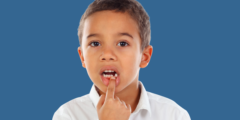 تثبيت الأسنان المخلخلة للاطفال وما هو سبب تخلخل وسقوط الأسنان الدائمة للأطفال؟