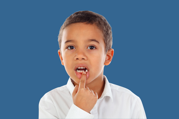 تثبيت الأسنان المخلخلة للاطفال