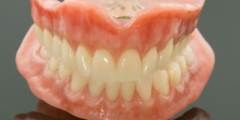 تثبيت الطقم الأسنان المتحرك | تعرف على كيفية تثبيت طقم الاسنان المتحرك