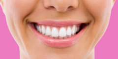 تجميل الأسنان الأمامية بدون تقويم | هل يمكن تجميل الاسنان بدون تقويم؟