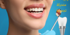 تركيبة اسنان متحركة تجميلية.. وما هي اسعار تركيب الأسنان المتحركة التجميلية؟