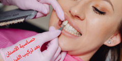 حساسية الاسنان بعد تركيب الفينير | تعرف على كيفية علاج حساسية الأسنان بعد الفينير