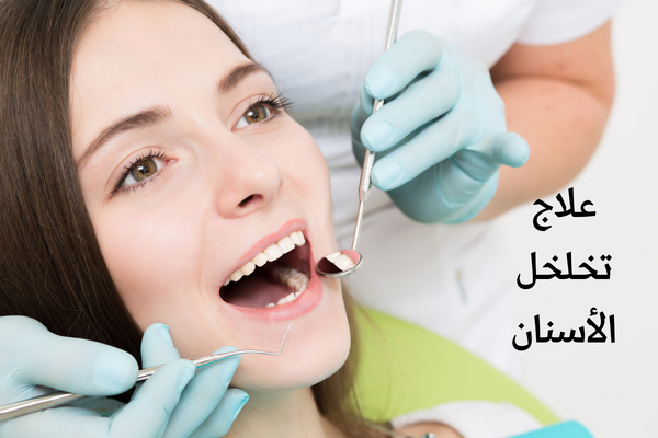 علاج تخلخل الأسنان