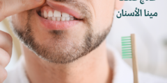 علاج ضعف مينا الأسنان | وما هي أسباب ضعف مينا الأسنان؟