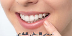 تبييض الأسنان بالفلاش | تعرف على أهم خطوات تبييض الأسنان بالفلاش