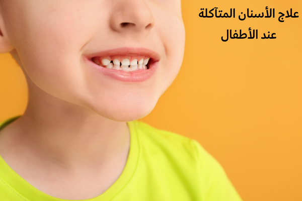 علاج الأسنان المتآكلة عند الأطفال