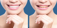 علاج حساسية الأسنان بعد التبييض.. وطريقة تخفيف الم حساسية الاسنان بعد التبييض